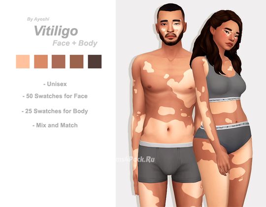 Витилиго "Vitiligo"