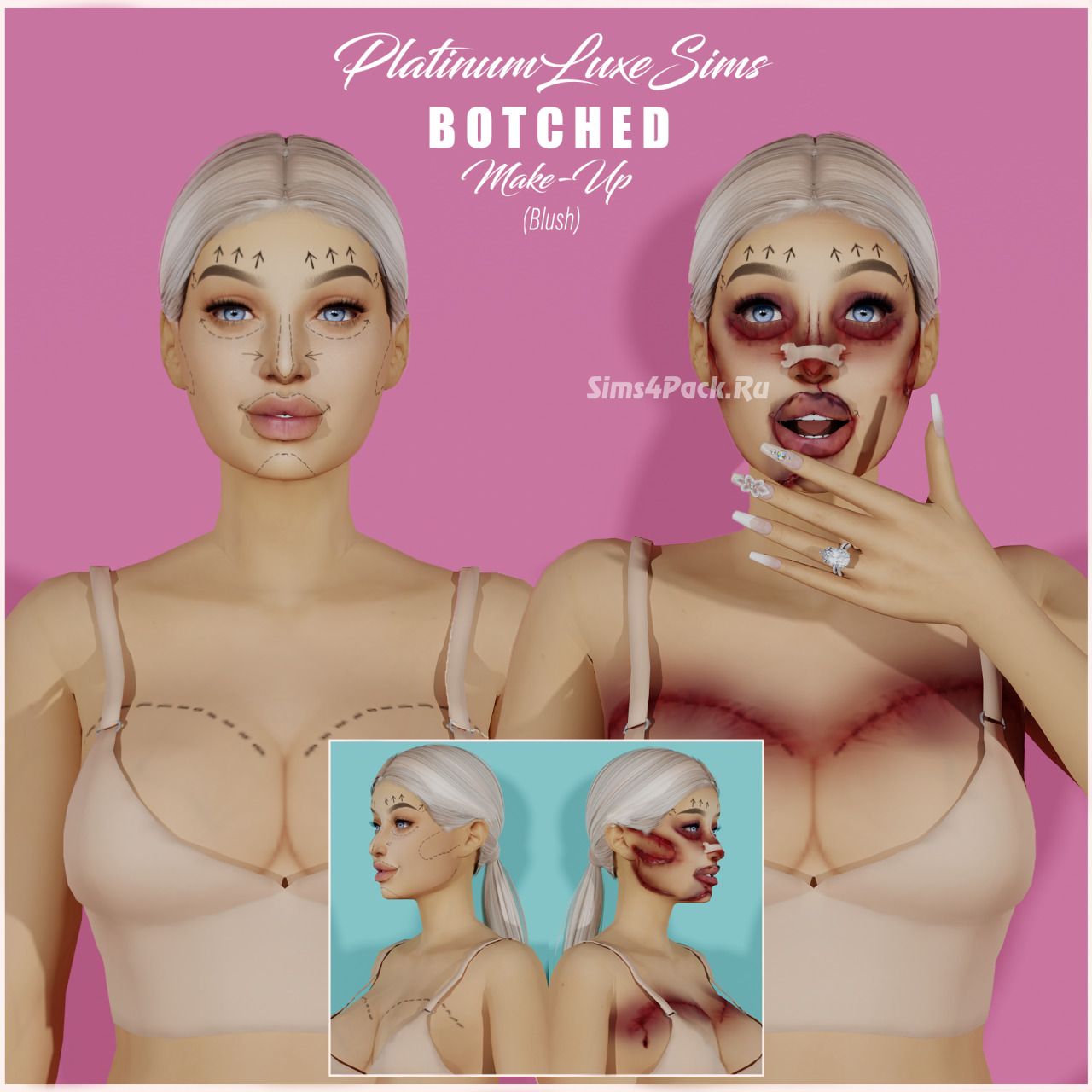Грим жертвы пластики "Botched"